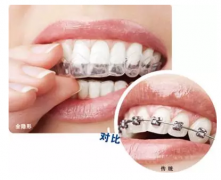 上海美莱率先发布 隐适美Invisalign G7新品上市！